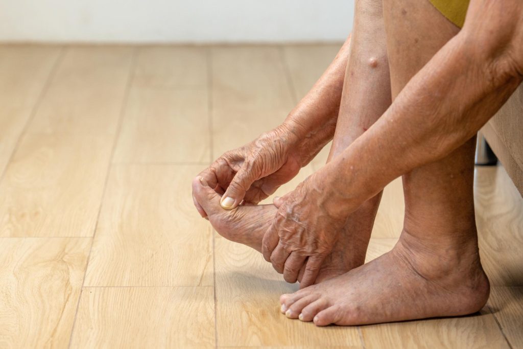 Skuteczne sposoby na spuchnięte stopy i kostki