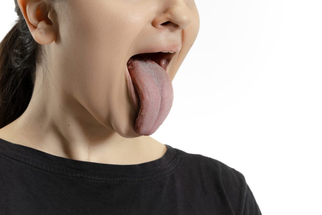 Ból i narośl pod językiem – przyczyny, objawy i leczenie